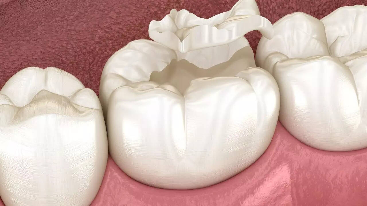 Enamel wearing away: Linked to acid reflux and GERD
